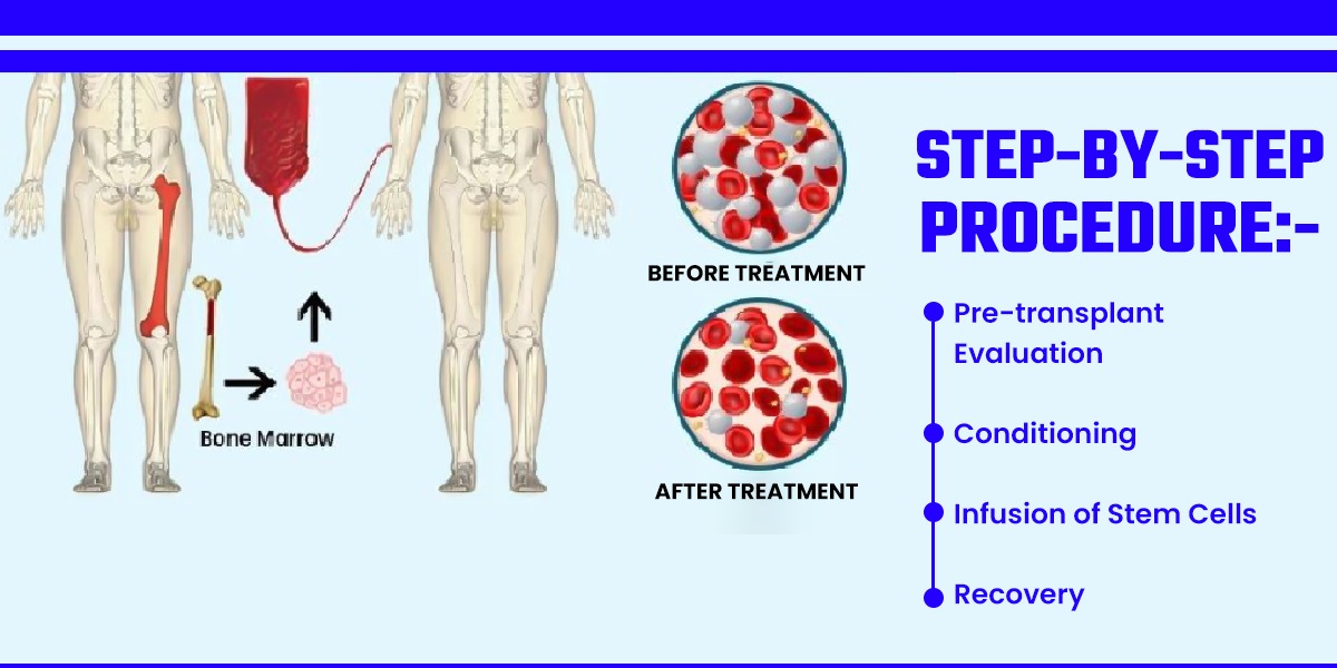 Step by Step Procedure